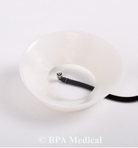 Mini Vacuum Bell 16 cm – Pediatric Pectus Excavatum Treatment Device