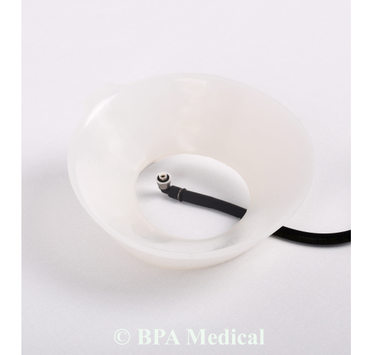 Mini Vacuum Bell 16 cm – Pediatric Pectus Excavatum Treatment Device