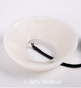 Small Vacuum Bell 19 cm – Chest Vacuum Device for Pectus Excavatum Therapy