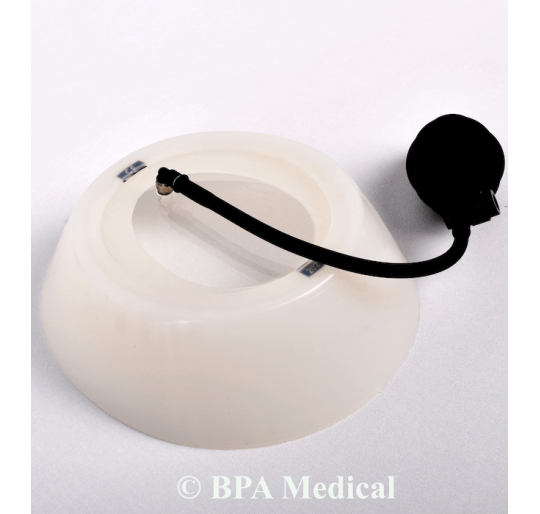 Small Vacuum Bell 19 cm – Chest Vacuum Device for Pectus Excavatum Therapy